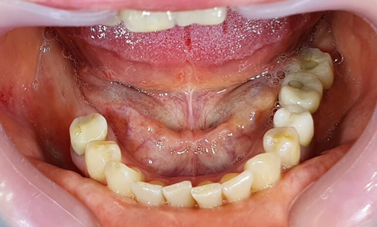 Metamorfoza 1 - przed