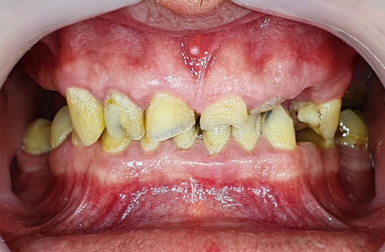 Metamorfoza 4 - przed