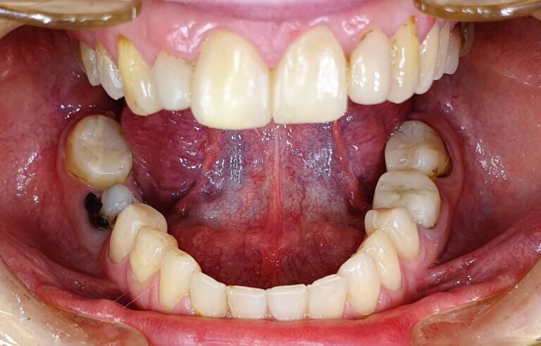 Metamorfoza 5 - przed