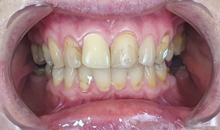 Metamorfoza 6 - przed